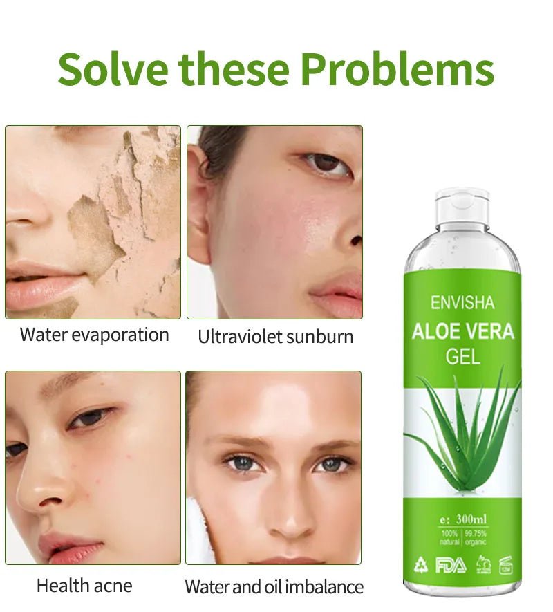 Aloe Vera Gel 300ml - Roger's Spot