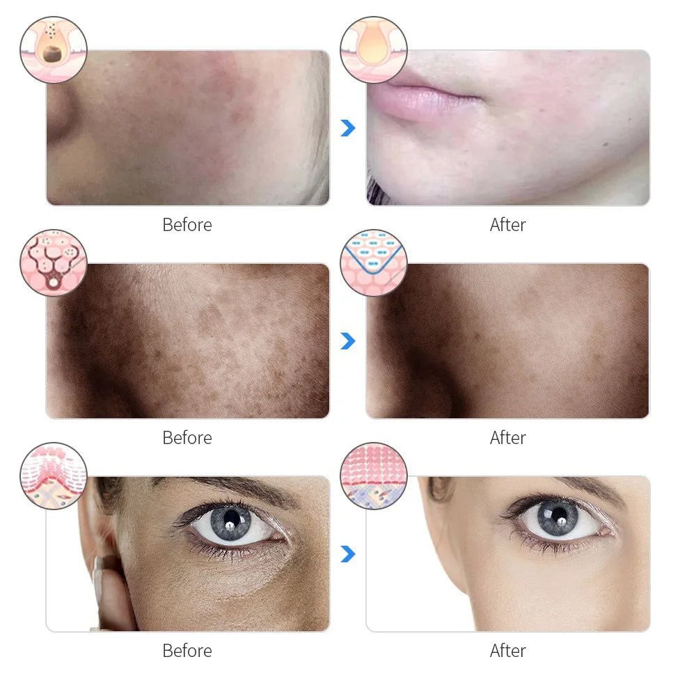 LED Facial Mask 7 - Color - Roger's Spot