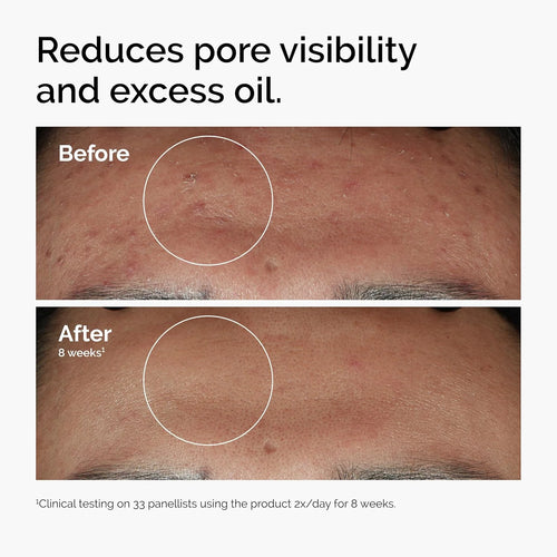 10% Niacinamide Zinc Serum - Roger's Spot
